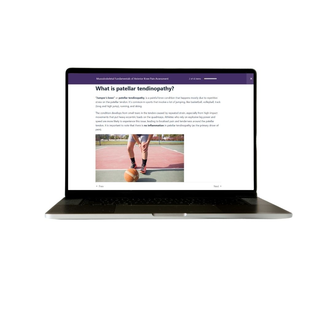 Online course laptop mockup on Musculoskeletal Fundamentals of Anterior Knee Pain Assessment